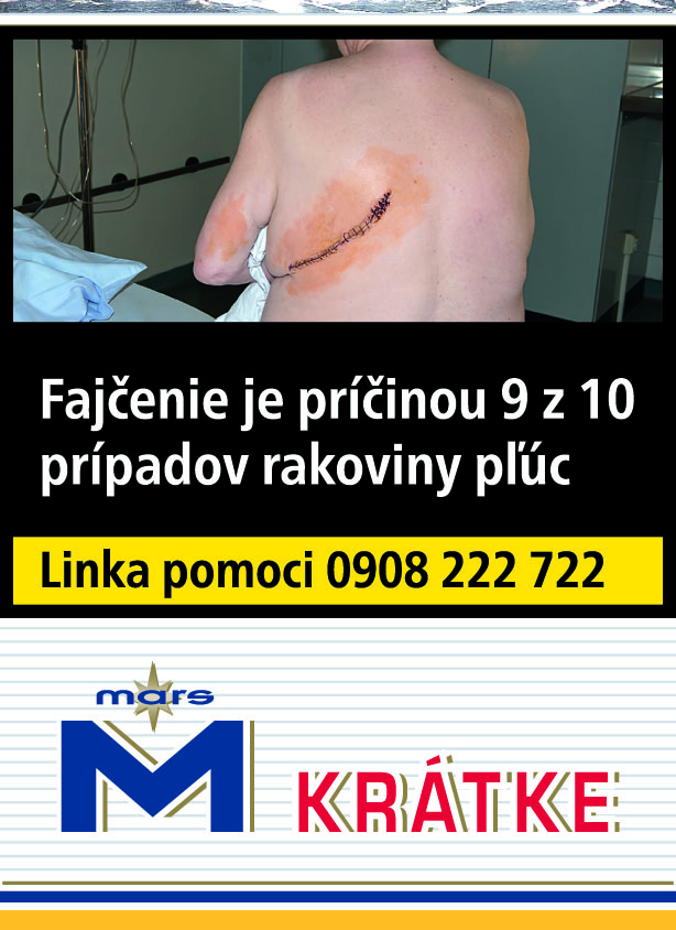 Mars Soft 70 krátke 20 ks KC 6,10 10 krab. kolok L mäkké bal. VO cena